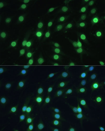 LBR Rabbit polyclonal antibody