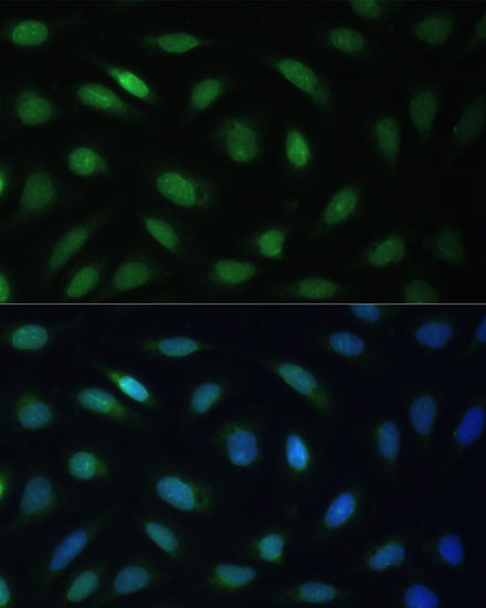 LBR Rabbit polyclonal antibody