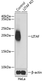 [KO Validated] LITAF Rabbit polyclonal antibody