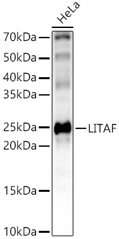 [KO Validated] LITAF Rabbit polyclonal antibody