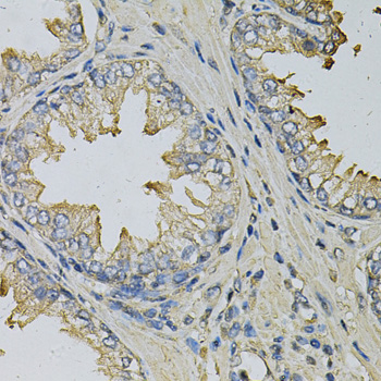 [KO Validated] LITAF Rabbit polyclonal antibody