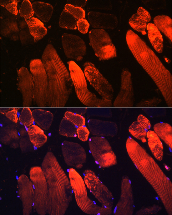 Myoglobin Rabbit polyclonal antibody