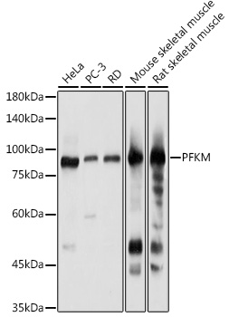 PFKM Rabbit polyclonal antibody