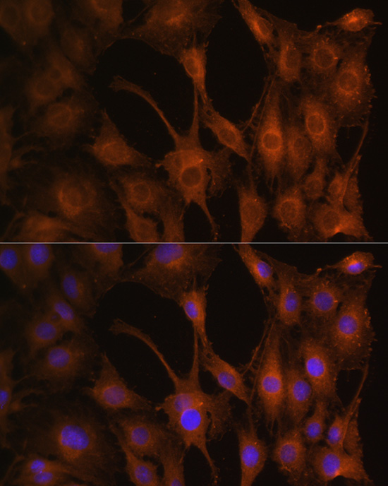 PFKM Rabbit polyclonal antibody