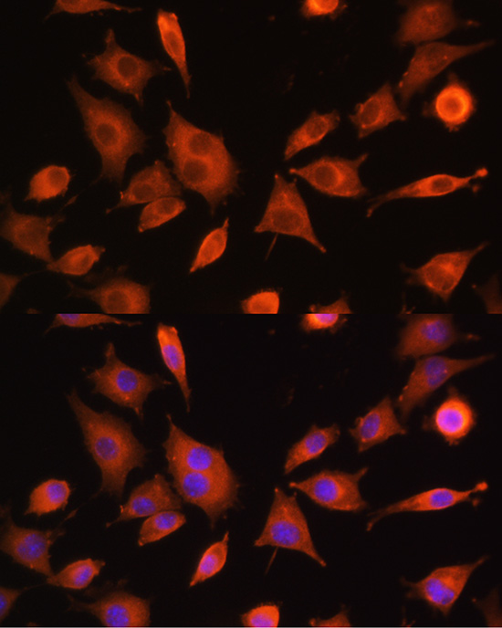 PFKM Rabbit polyclonal antibody
