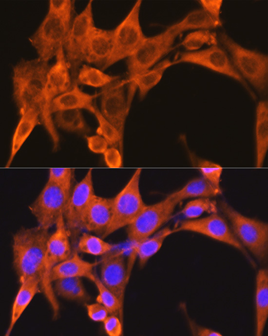 PFKM Rabbit polyclonal antibody