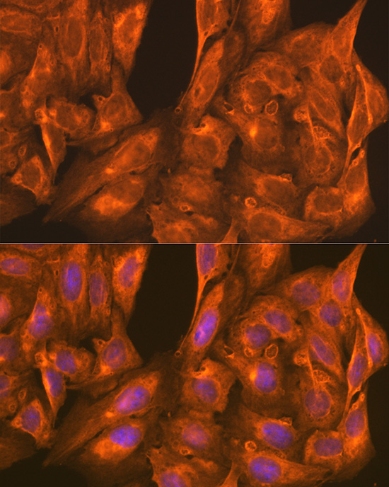 PFKM Rabbit polyclonal antibody
