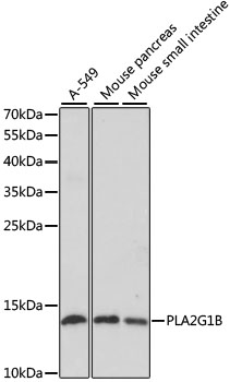 PLA2G1B Rabbit polyclonal antibody