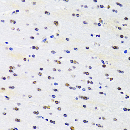 PRPF3 Rabbit polyclonal antibody