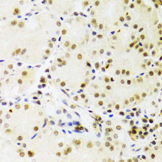 PRPF3 Rabbit polyclonal antibody