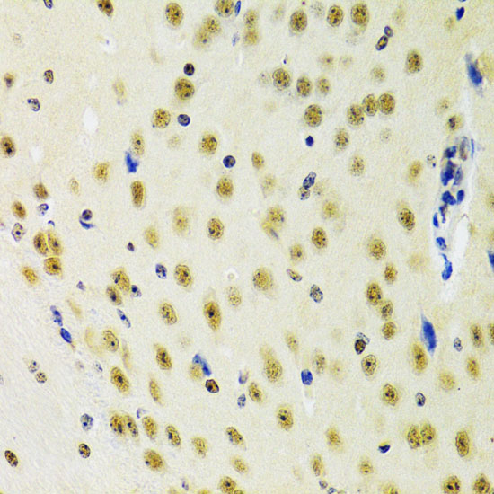 PRPF3 Rabbit polyclonal antibody