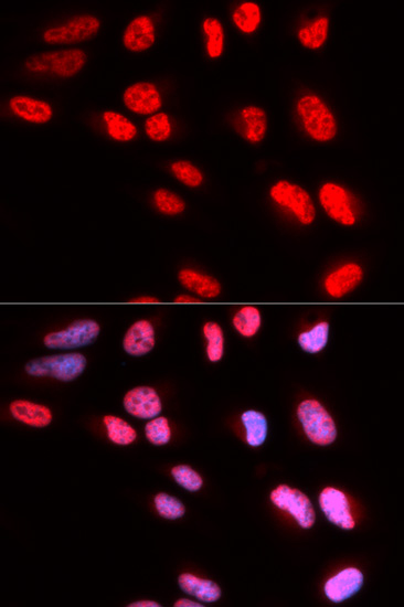PRPF3 Rabbit polyclonal antibody