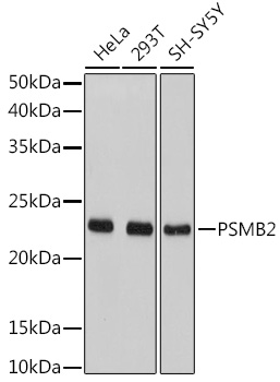 PSMB2 Rabbit polyclonal antibody