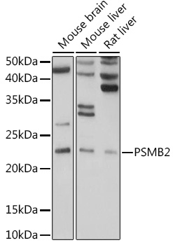 PSMB2 Rabbit polyclonal antibody