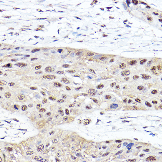 PSMB2 Rabbit polyclonal antibody