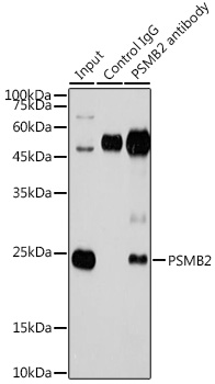 PSMB2 Rabbit polyclonal antibody