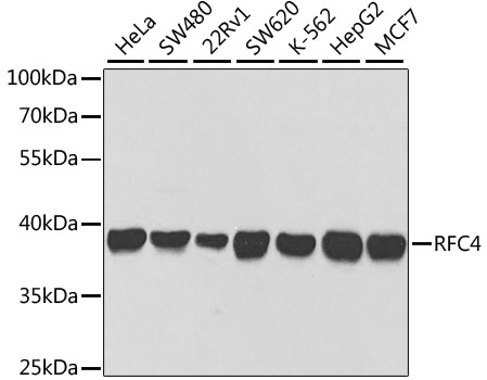 RFC4 Rabbit polyclonal antibody