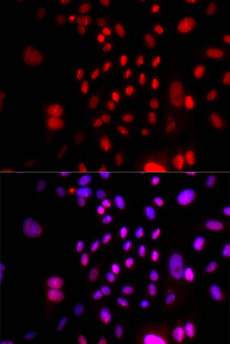 RFC4 Rabbit polyclonal antibody