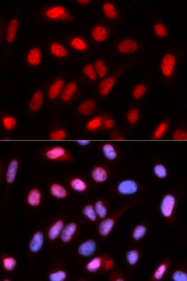 RFC4 Rabbit polyclonal antibody
