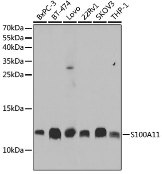 [KO Validated] S100A11 Rabbit polyclonal antibody