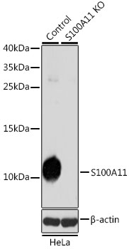 [KO Validated] S100A11 Rabbit polyclonal antibody