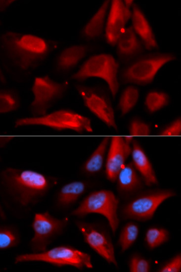 [KO Validated] S100A11 Rabbit polyclonal antibody
