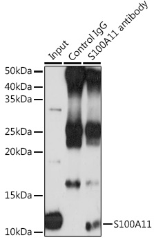 [KO Validated] S100A11 Rabbit polyclonal antibody