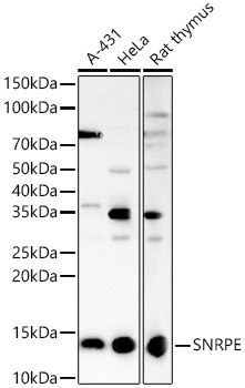 SNRPE Rabbit polyclonal antibody