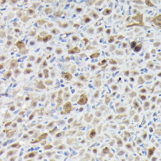 SNRPE Rabbit polyclonal antibody