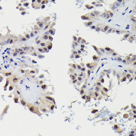 SNRPE Rabbit polyclonal antibody