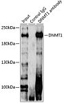 Immunoprecipitation - DNMT1 Rabbit pAb (A5495)