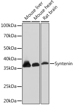 Syntenin Rabbit monoclonal antibody