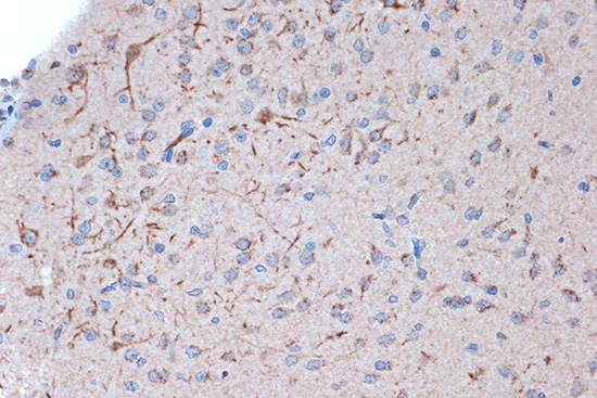 Syntenin Rabbit monoclonal antibody