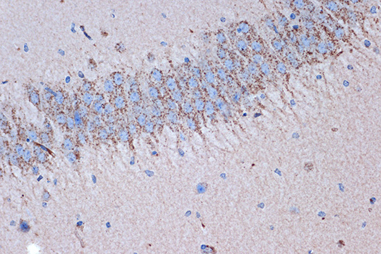 Syntenin Rabbit monoclonal antibody