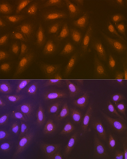 Syntenin Rabbit monoclonal antibody