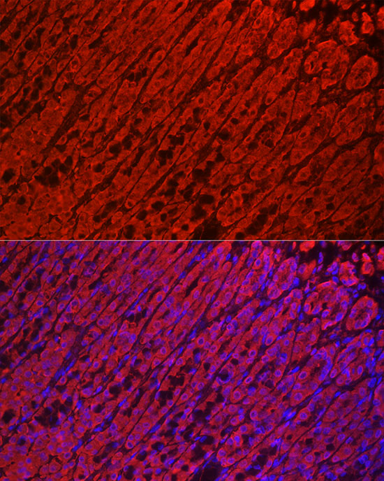 ALDH3A1 Rabbit polyclonal antibody