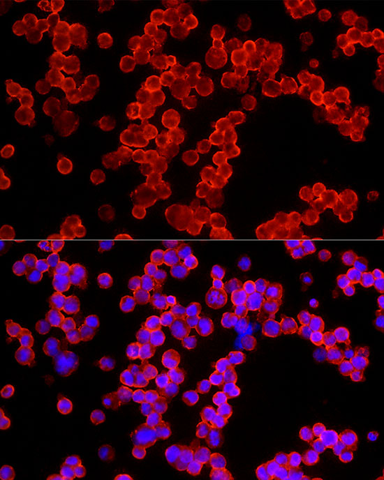 ALDH3A1 Rabbit polyclonal antibody