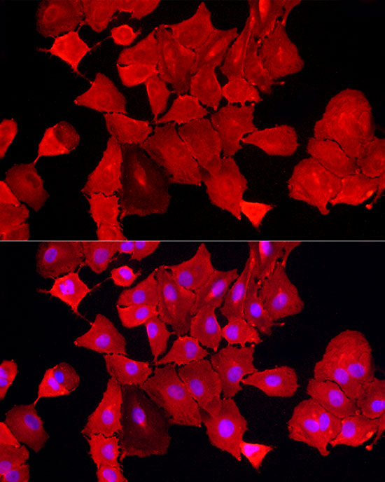 ALDH3A1 Rabbit polyclonal antibody