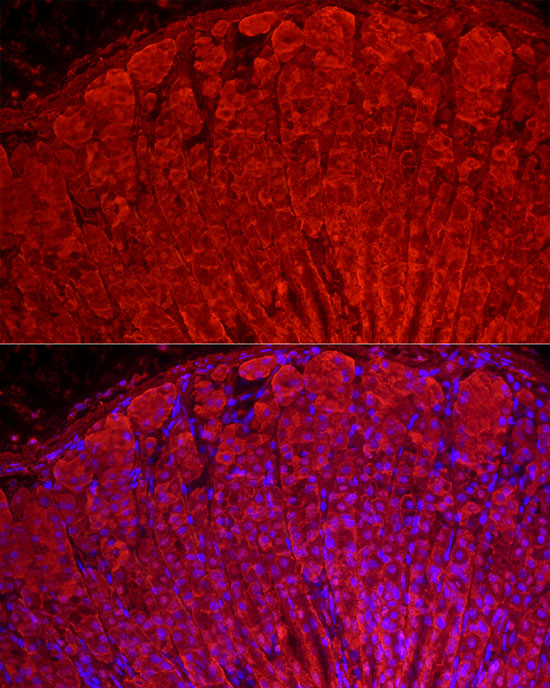 ALDH3A1 Rabbit polyclonal antibody