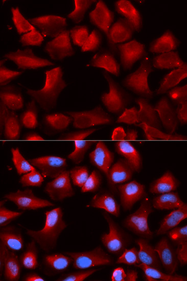 [KO Validated] DNAJB1 Rabbit polyclonal antibody