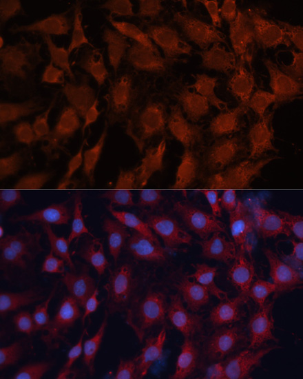 [KO Validated] DNAJB1 Rabbit polyclonal antibody