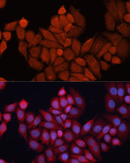 [KO Validated] DNAJB1 Rabbit polyclonal antibody