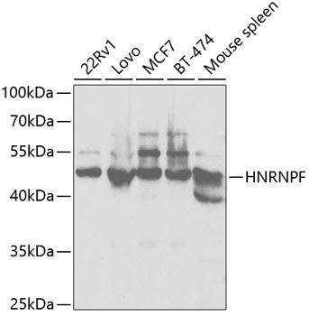 [KO Validated] HNRNPF Rabbit polyclonal antibody
