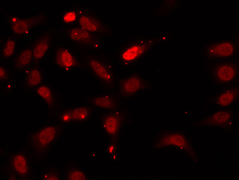 [KO Validated] HNRNPF Rabbit polyclonal antibody