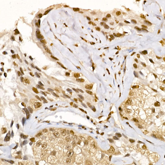 AKT1 Rabbit polyclonal antibody