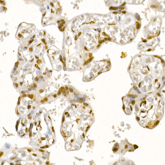 AKT1 Rabbit polyclonal antibody