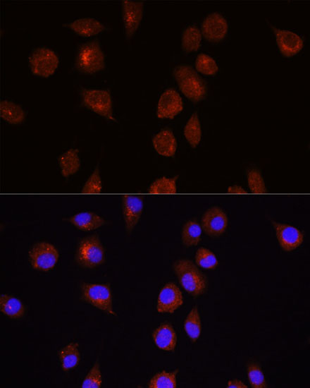 AKT1 Rabbit polyclonal antibody