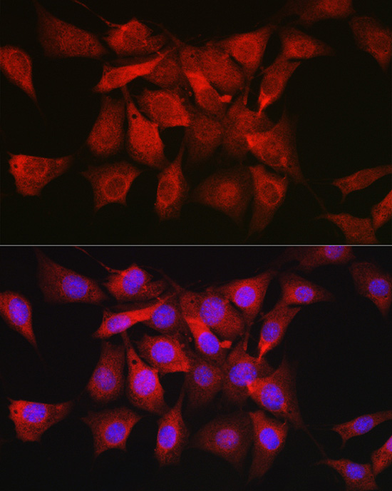 AKT1 Rabbit polyclonal antibody