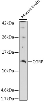 CGRP Rabbit polyclonal antibody