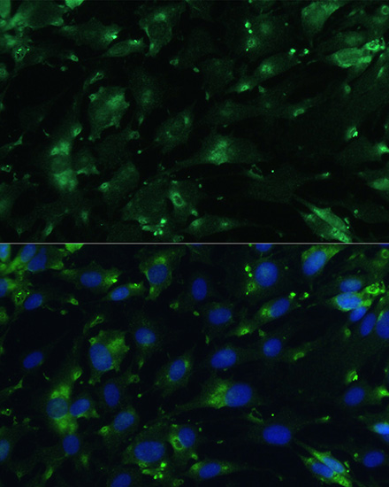 CGRP Rabbit polyclonal antibody
